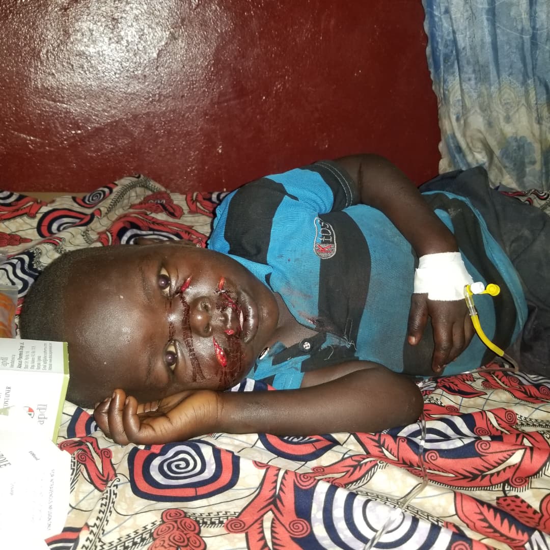 Faradje : un enfant agressé par un chacal à Tadu